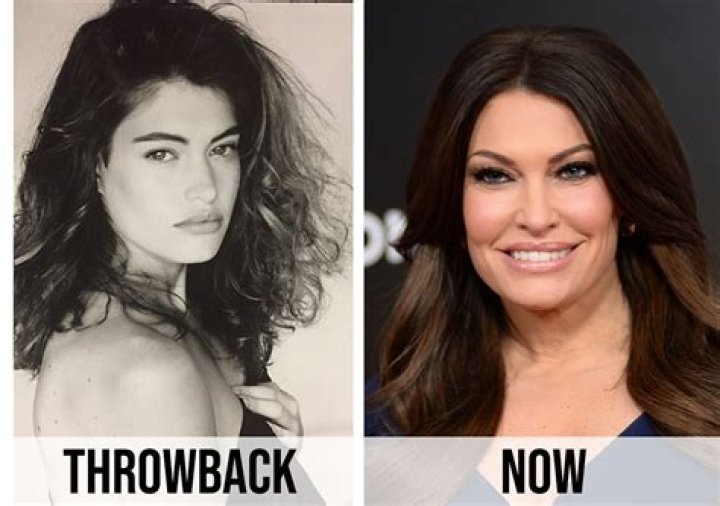 Kimberly Guilfoyle's Plastic Surgery Journey: Unveiling The Truth