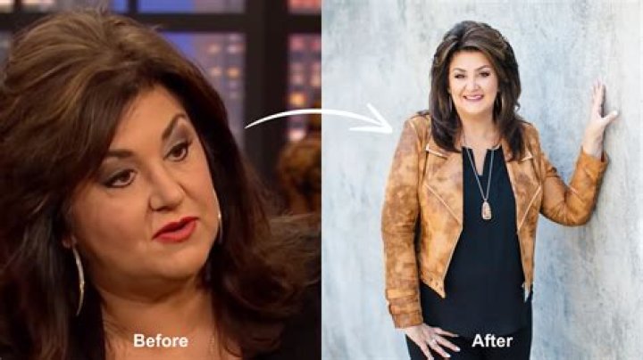 Unveiling The Breakthroughs Of Joni Lamb Weight Loss Surgery